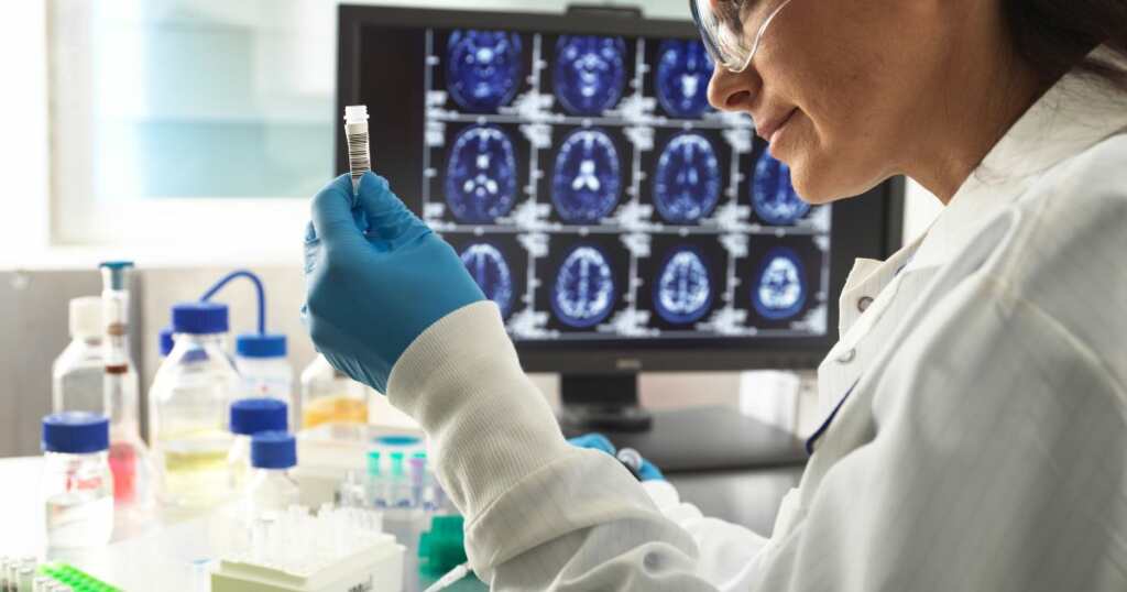Alzheimer researcher - woman holding a sample test - Cannabis treatment