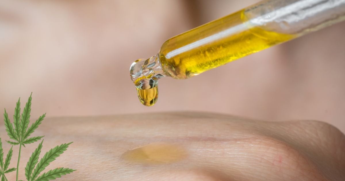 Cannabis Oil CBD - benefits for eczema relief