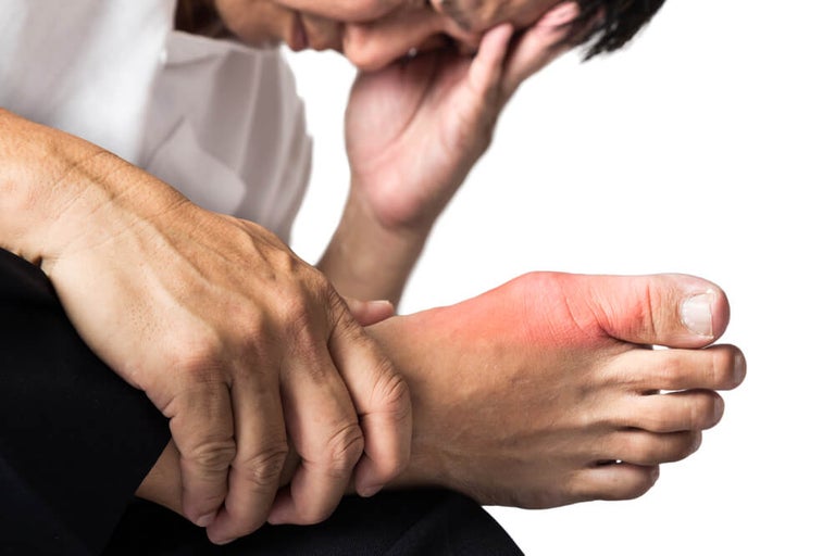 Can Weed Cause Gout
