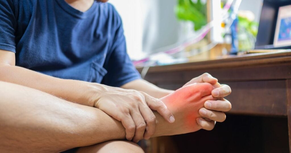 Inflammation on the foot. A young man holds his foot with both hands. The section that is inflamed. is coloured red.