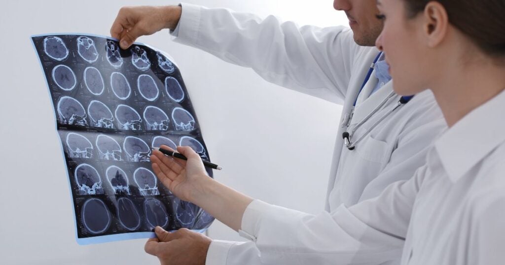 Doctor holding up a scan of the human brain, looking for multiple sclerosis.