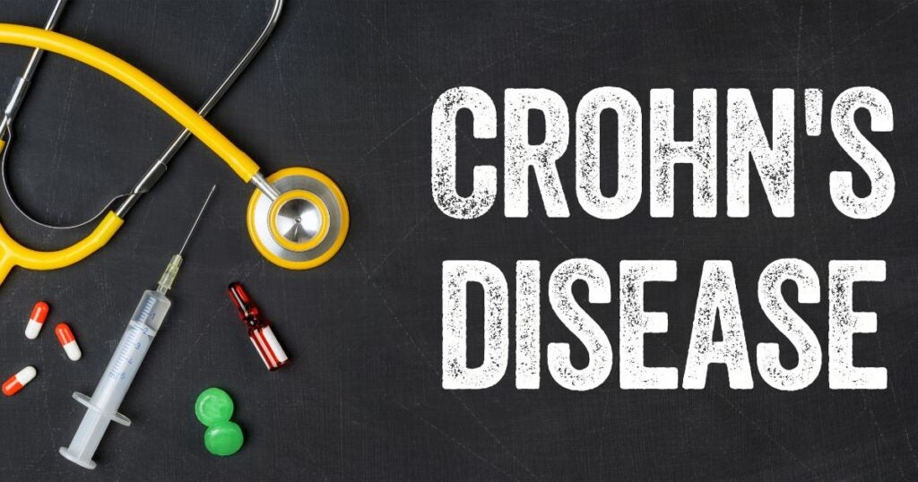 Crohn's disease written in text over a black background. Medical devices sit next to the text.