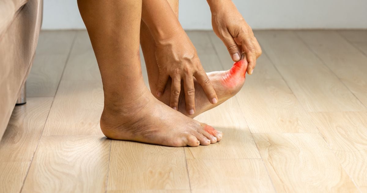 Marijuana and Gout: Treatment Using Cannabis & Its Connection