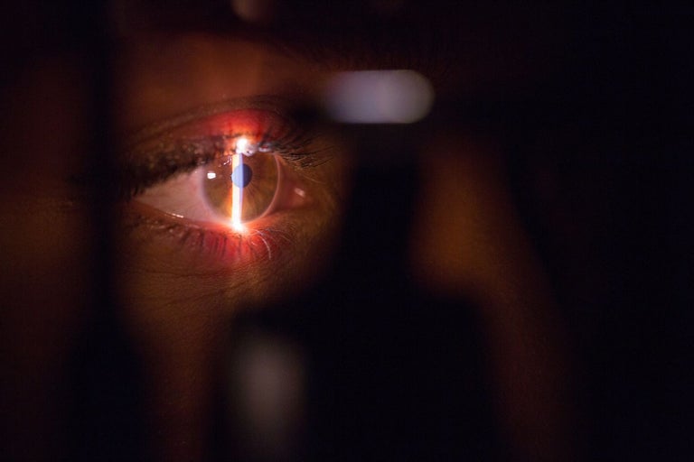 Lasik Surgery. Human eye wide open in a dark room. Red vertical line laser is flashing on the eye.