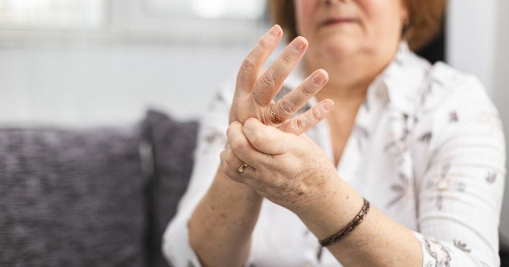 Elderly woman with Arthritis in her hands - needs relief
