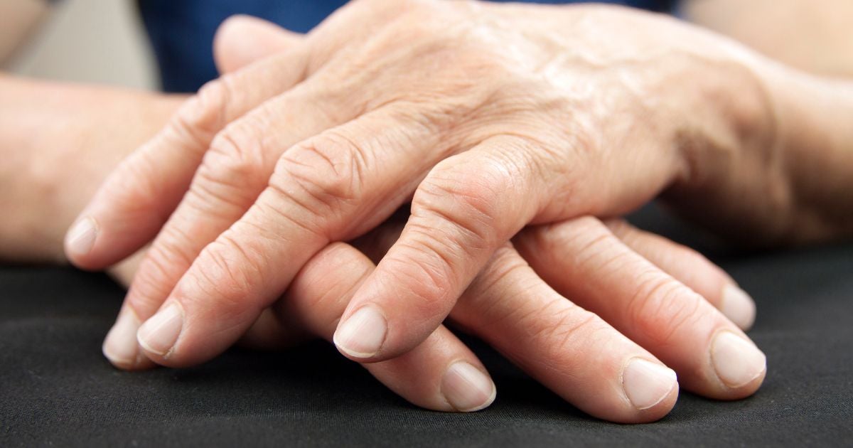 The Best Cannabis Strains for Arthritis Pain Relief: Discover Nature’s Remedy